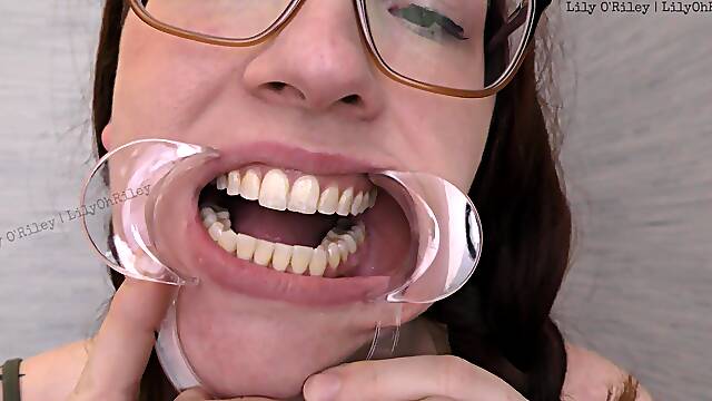 Glasses and Gape: 11-min Dental Speculum-stretched Drool Session